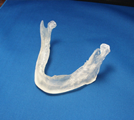 歯科用モデル 光造形画像17